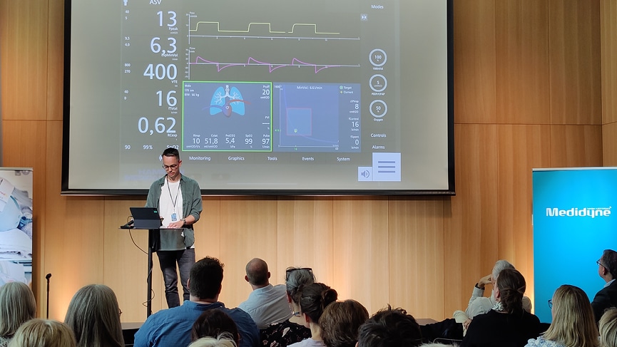 Is closed loop ventilation a solution for individualized ventilation, and can transpulmonary pressure be a part of this.